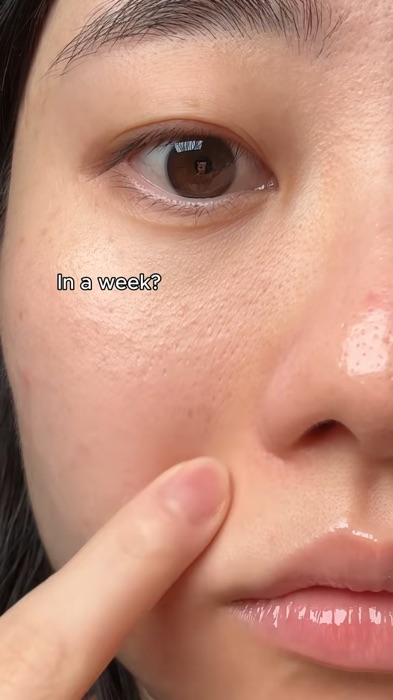 in a week? buy now #skincare #rejuranskincare #rejuran